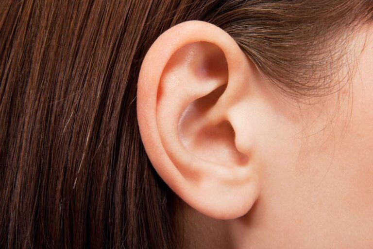 Otoplastia: El tratamiento orejas de soplillo u orejas separadas en Murcia y Alicante