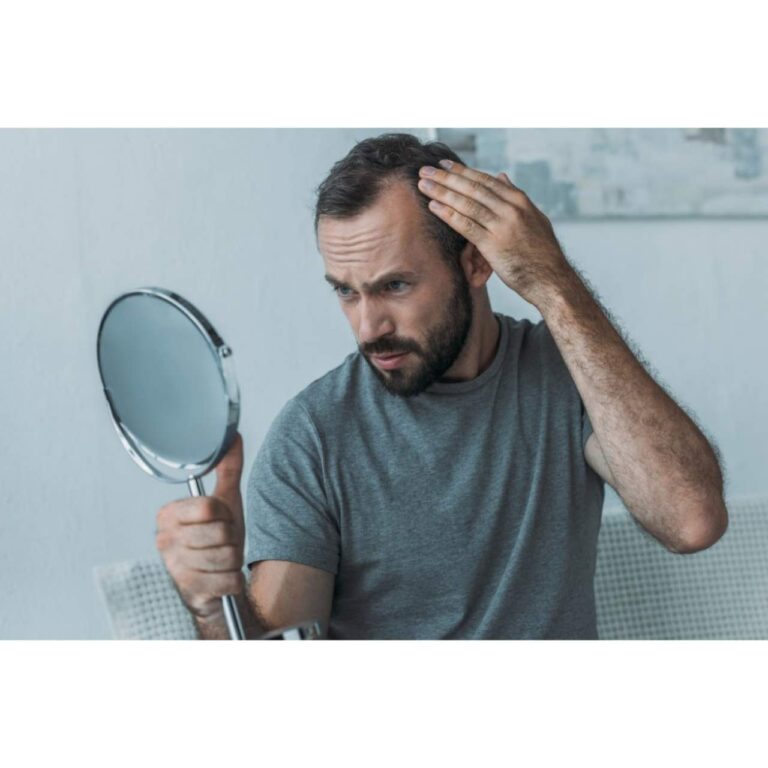 Prevenir la caída del cabello en Barcelona: Dr. Carlos Zito