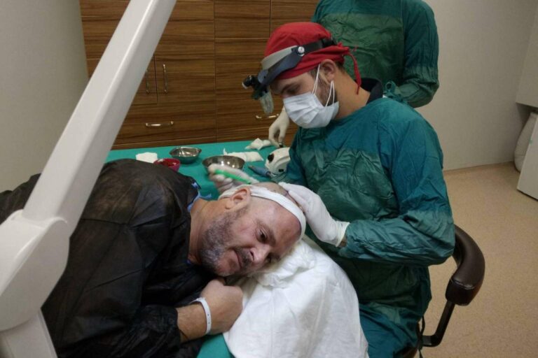 FUE Hair Transplant System realiza injerto capilar Turquía todo incluido