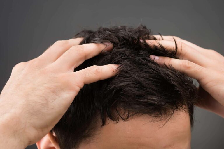 Tratamiento capilar para combatir la caída del cabello en CharoConector Healthy Style