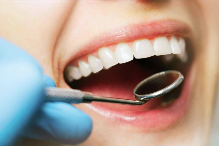 Clínicas Dental Bell, tecnología y profesionalidad en odontología estética en Sevilla