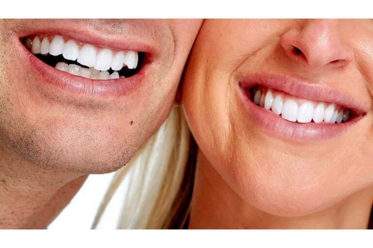 DeltaDent, la clínica dental de Madrid para lucir una sonrisa bonita