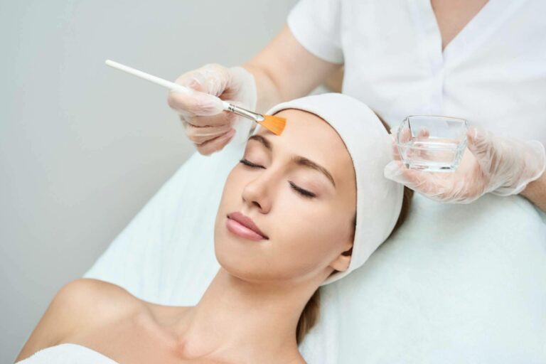 Tratamientos de peeling químico en diferentes partes del cuerpo, en Crina Rus Beauty Center