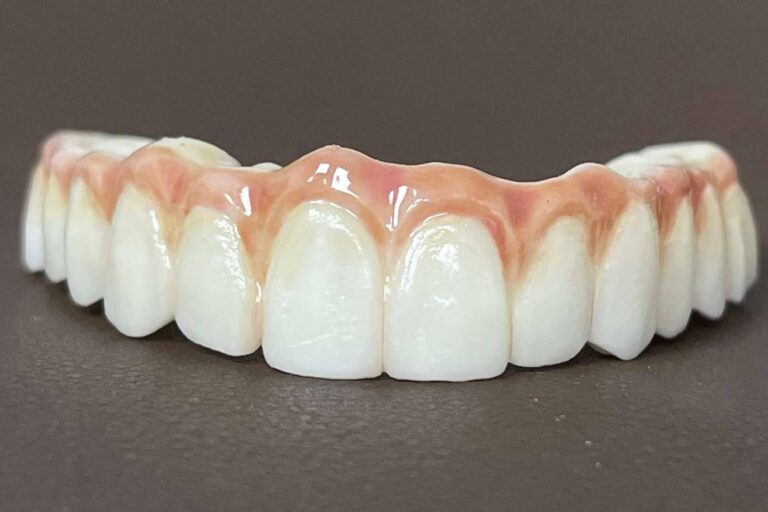 La impresión 3D devuelve los dientes en un día, con Dentinova