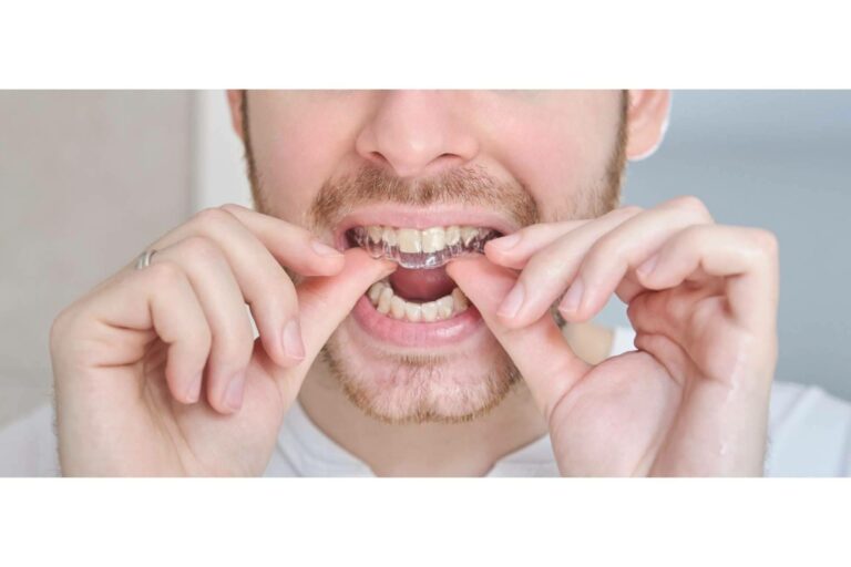 Las ventajas de la ortodoncia invisible, por Clínica Dental Delgado