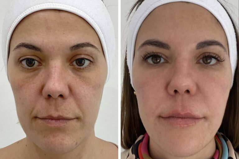Los tratamientos faciales de Clínica VISO permiten a las personas mejorar su apariencia
